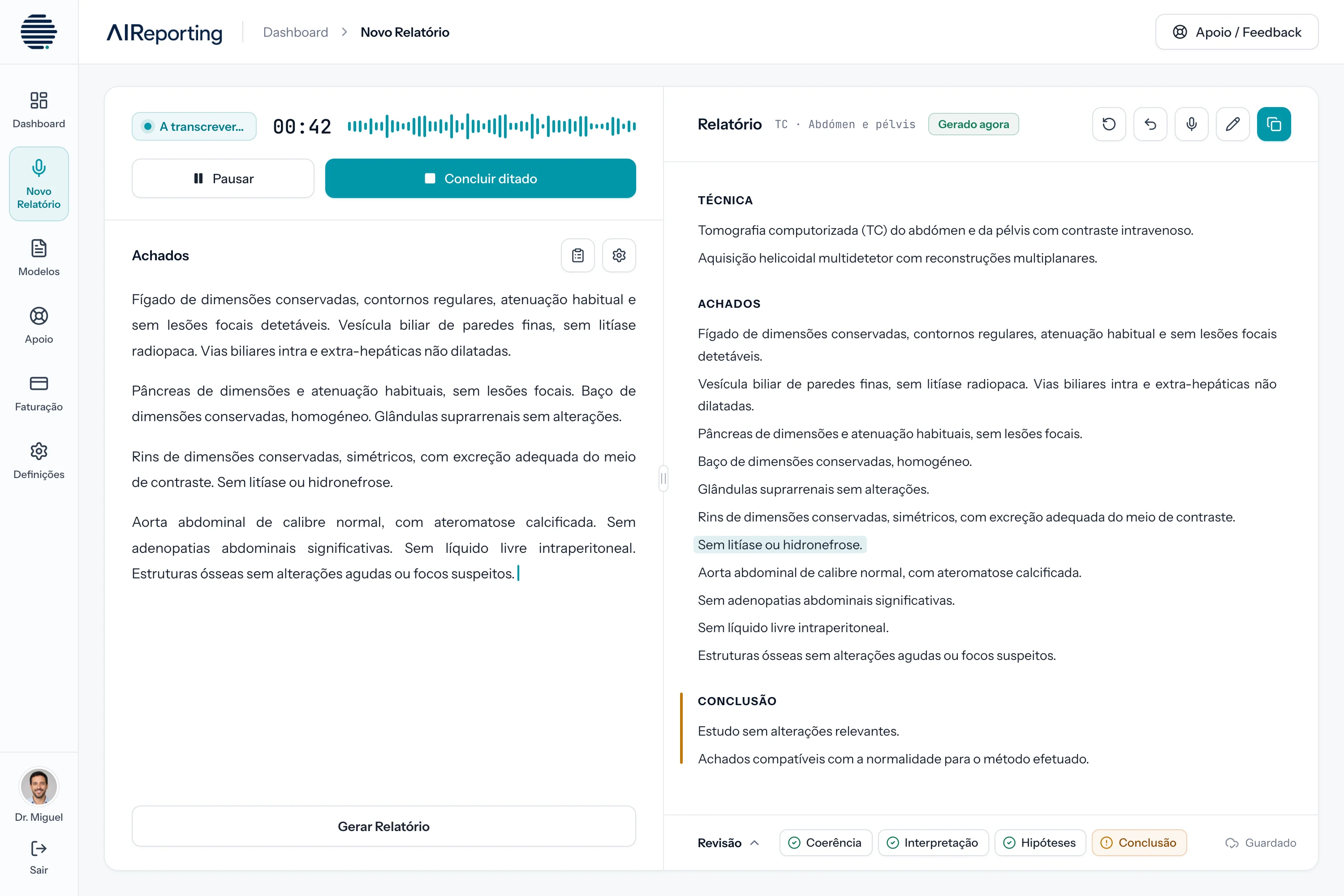 O ecrã Novo Relatório em modo claro: a transcrição à esquerda, o relatório gerado à direita com os achados positivos destacados e a barra da revisão em baixo.